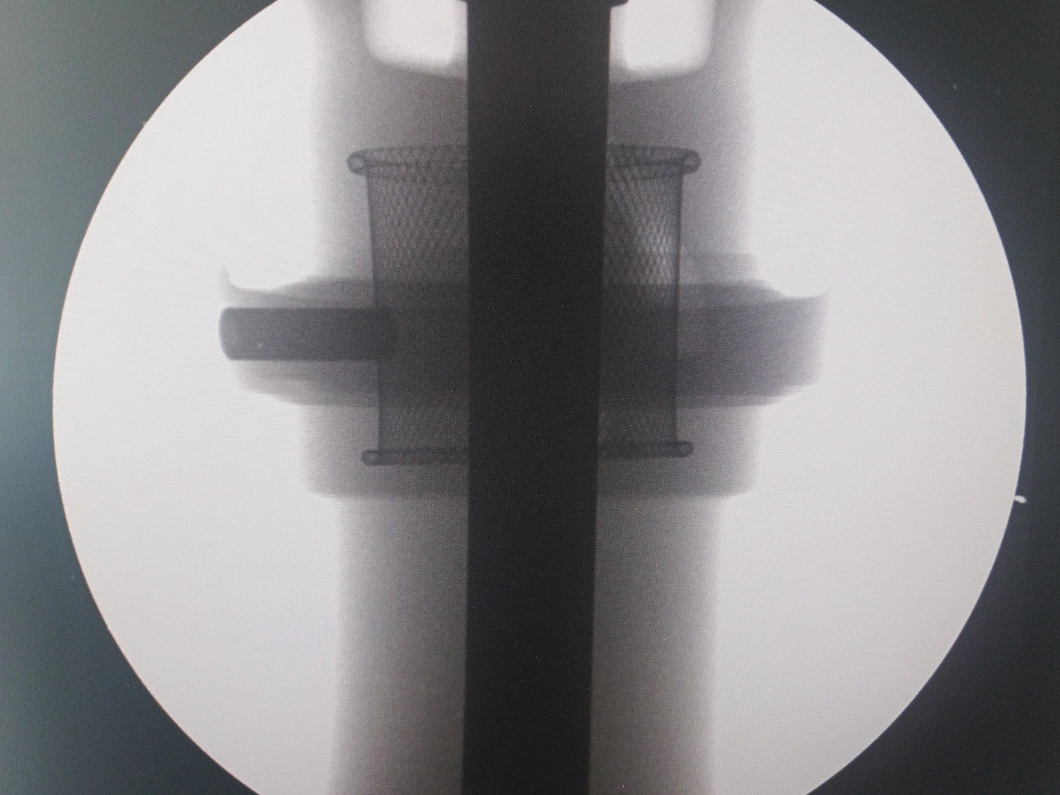 Quality Control for Single Crystal Turbine Castings